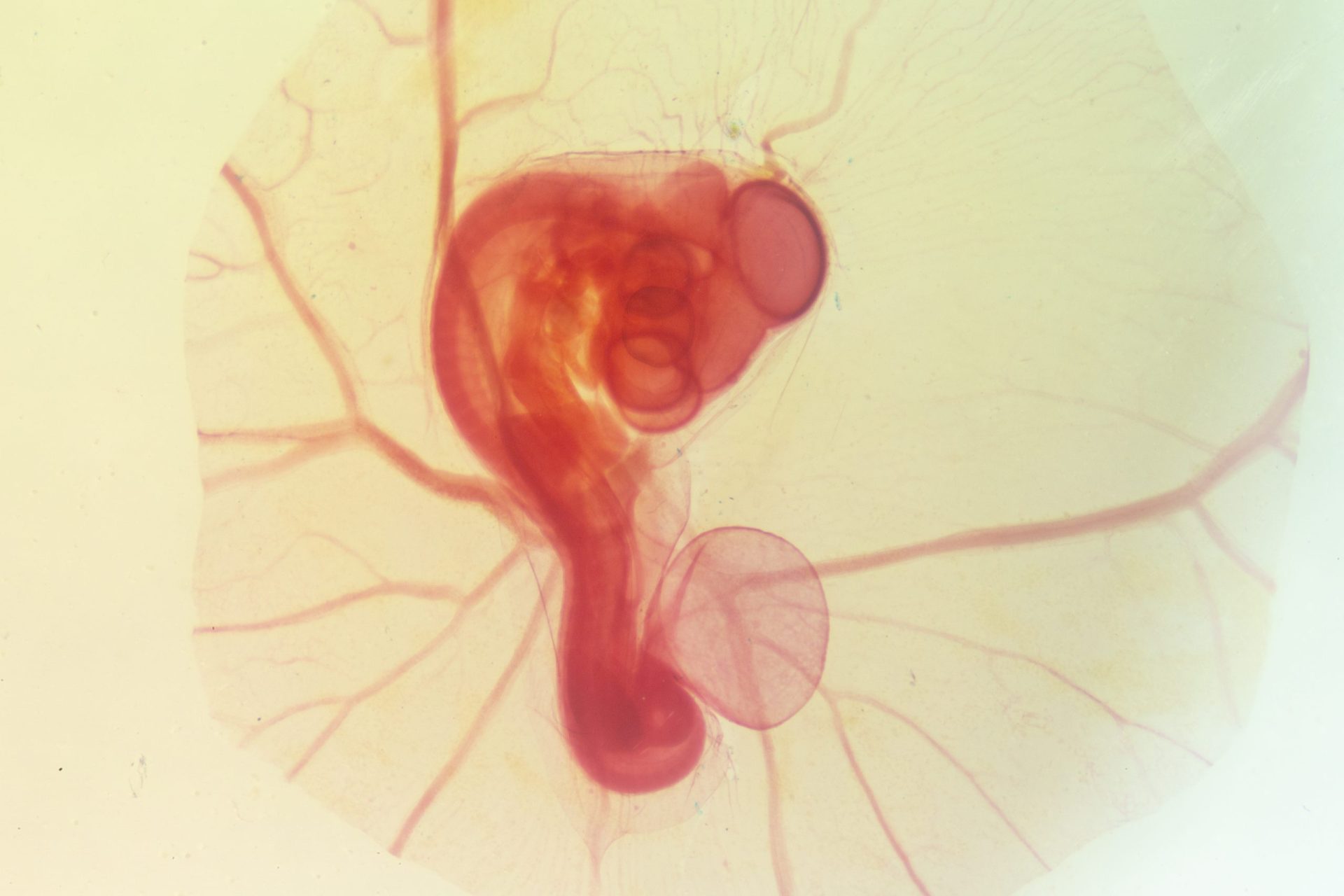 development,of,the,embryo,chicken,the,development,of,the,chick,on